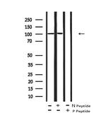 Phospho-STAT2 (Tyr631) Polyclonal Antibody
