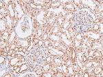 Phospho-STAT4 (Ser721) Antibody in Immunohistochemistry (Paraffin) (IHC (P))