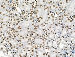 Phospho-CAMKK alpha/beta (Ser458, Ser495) Antibody in Immunohistochemistry (Paraffin) (IHC (P))
