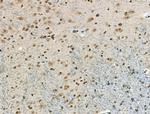 Phospho-CAMKK alpha/beta (Ser458, Ser495) Antibody in Immunohistochemistry (Paraffin) (IHC (P))
