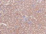Phospho-CDK1 (Thr161) Antibody in Immunohistochemistry (Paraffin) (IHC (P))