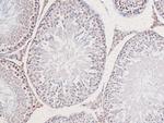 Phospho-CDK1 (Thr161) Antibody in Immunohistochemistry (Paraffin) (IHC (P))