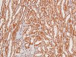 Phospho-EphA8 (Tyr839) Polyclonal Antibody