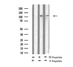 Phospho-EphB1/EphB2/EphB3/EphB4 (Tyr600, Tyr602, Tyr614, Tyr596) Polyclonal Antibody