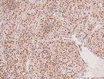 Phospho-FGFR2 (Tyr769) Polyclonal Antibody