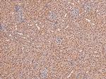Phospho-FGFR2 (Tyr769) Antibody in Immunohistochemistry (Paraffin) (IHC (P))