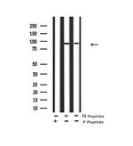 Phospho-FGFR3 (Tyr760) Polyclonal Antibody
