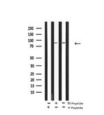 Phospho-FGFR4 (Tyr754) Antibody in Western Blot (WB)