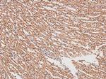Phospho-FGR (Tyr412) Polyclonal Antibody