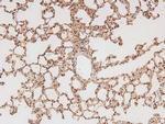 Phospho-FLT3 (Tyr591) Antibody in Immunohistochemistry (Paraffin) (IHC (P))