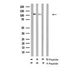 Phospho-FLT3 (Tyr589) Polyclonal Antibody