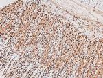 Phospho-JAK2/JAK3 (Tyr966, Tyr939) Antibody in Immunohistochemistry (Paraffin) (IHC (P))