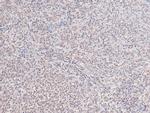 Phospho-c-Kit (Tyr568) Antibody in Immunohistochemistry (Paraffin) (IHC (P))