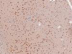 Phospho-c-Kit (Tyr568) Antibody in Immunohistochemistry (Paraffin) (IHC (P))