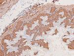 Phospho-c-Kit (Ser746) Antibody in Immunohistochemistry (Paraffin) (IHC (P))