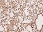 Phospho-c-Kit (Ser746) Antibody in Immunohistochemistry (Paraffin) (IHC (P))