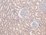 Phospho-MEKK2 (Ser520) Antibody in Immunohistochemistry (Paraffin) (IHC (P))