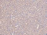 Phospho-MEKK2 (Ser520) Polyclonal Antibody