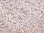 Phospho-MOK (Tyr161) Polyclonal Antibody