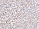 Phospho-MOK (Tyr161) Antibody in Immunohistochemistry (Paraffin) (IHC (P))