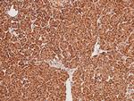 Phospho-MSK2 (Ser196) Polyclonal Antibody