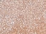 Phospho-MSK2 (Ser196) Antibody in Immunohistochemistry (Paraffin) (IHC (P))