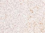 Phospho-PDGFRB (Tyr579, Tyr581) Antibody in Immunohistochemistry (Paraffin) (IHC (P))