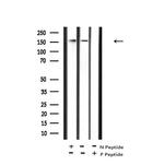Phospho-PDGFRB (Tyr579, Tyr581) Antibody in Western Blot (WB)
