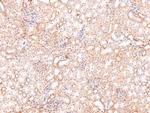 Phospho-SIK1/SIK2/SIK3 (Thr182, Thr175, Thr221) Antibody in Immunohistochemistry (Paraffin) (IHC (P))