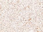 Phospho-SIK1/SIK2/SIK3 (Thr182, Thr175, Thr221) Antibody in Immunohistochemistry (Paraffin) (IHC (P))