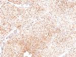 Phospho-ROS1 (Tyr2274) Polyclonal Antibody