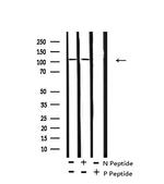 Phospho-TIE1 (Tyr1117) Antibody in Western Blot (WB)