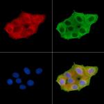 Phospho-TIE1 (Tyr1117) Polyclonal Antibody