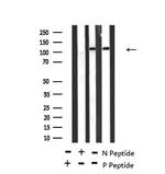 Phospho-TEK (Ser1119) Polyclonal Antibody