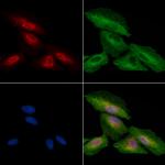 Phospho-ZAK (Ser165) Polyclonal Antibody