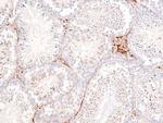 Phospho-PDGFRA (Tyr720) Antibody in Immunohistochemistry (Paraffin) (IHC (P))