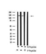 Phospho-PDGFRA (Tyr720) Antibody in Western Blot (WB)