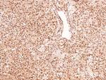 Phospho-RET (Tyr1015) Polyclonal Antibody