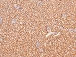 Phospho-BRCA1 (Ser1387) Polyclonal Antibody