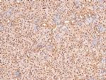 Phospho-BRCA1 (Ser1497) Antibody in Immunohistochemistry (Paraffin) (IHC (P))