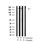 Phospho-BRCA1 (Ser1497) Antibody in Western Blot (WB)