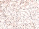 Phospho-RARA/RARB (Ser96) Antibody in Immunohistochemistry (Paraffin) (IHC (P))