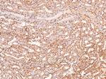 Phospho-LRP1 (Ser4520) Antibody in Immunohistochemistry (Paraffin) (IHC (P))