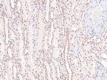 Phospho-FGFR Pan (Tyr653, Tyr654) Antibody in Immunohistochemistry (Paraffin) (IHC (P))