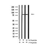 Phospho-eIF2b epsilon (Ser525) Antibody in Western Blot (WB)