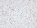 Phospho-CD45 (Tyr1218) Antibody in Immunohistochemistry (Paraffin) (IHC (P))