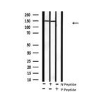 Phospho-CD45 (Tyr1218) Antibody in Western Blot (WB)