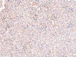 Phospho-Androgen Receptor (Tyr269) Antibody in Immunohistochemistry (Paraffin) (IHC (P))