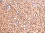 Phospho-FGFR1/FGFR2 (Tyr730, Tyr733) Polyclonal Antibody