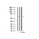 Phospho-IFNAR1 (Ser535) Antibody in Western Blot (WB)